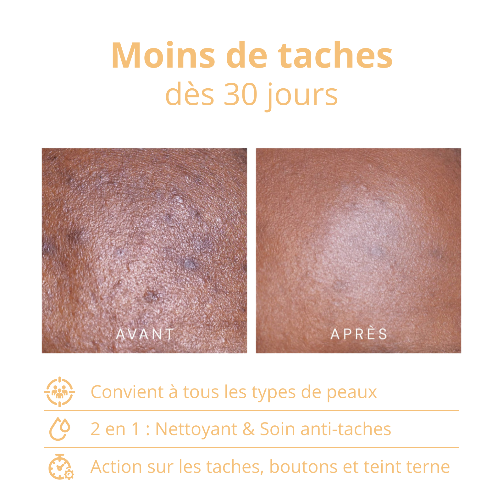 Sérum Anti Imperfections