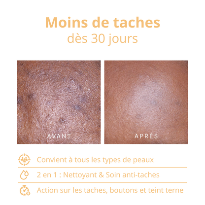 Sérum Anti Imperfections