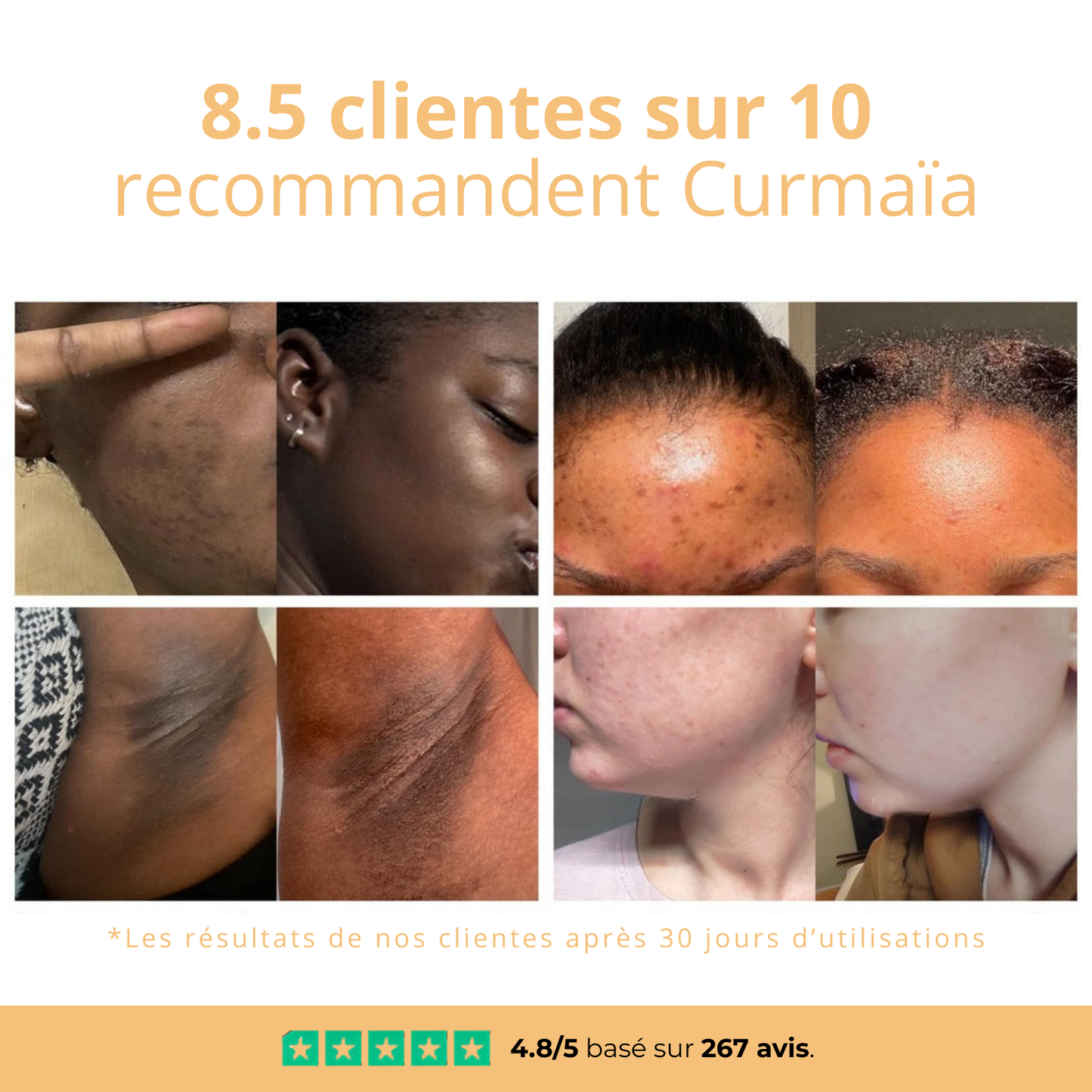 Sérum Anti Imperfections